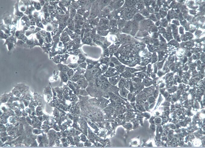 OE-33(OE33) 人食管癌细胞上海盖宁生物科技有限公司专业细胞供应【官方