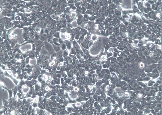 OE-33(OE33) 人食管癌细胞上海盖宁生物科技有限公司专业细胞供应【官方